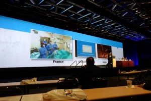 Live Resleeve procedure from France to IFSO 2014 in Montreal, Canada for the International Sleeve summit.